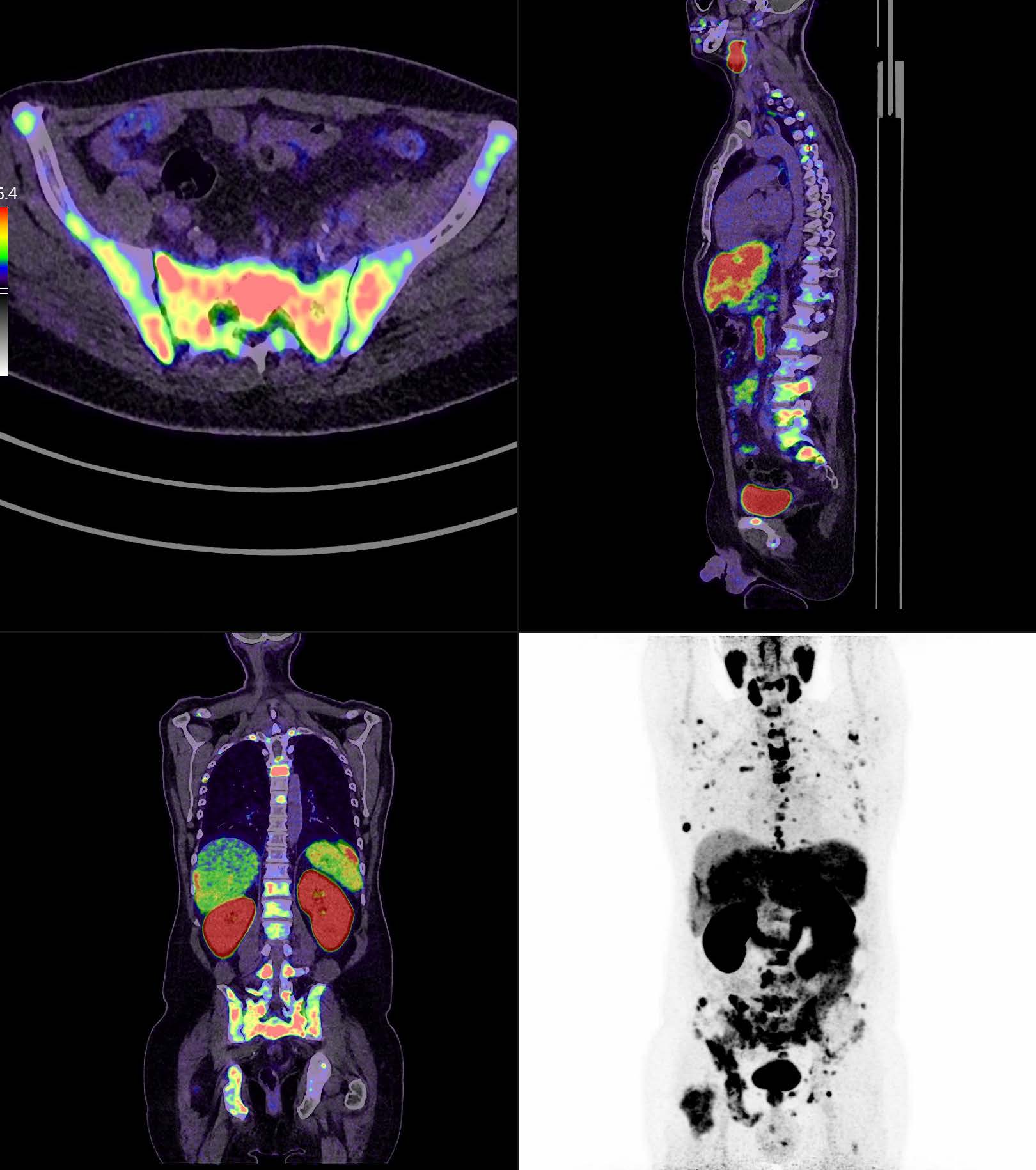 Neue PET/CT-Indikationen seit Januar 2021 – PET Diagnostik Bern AG
